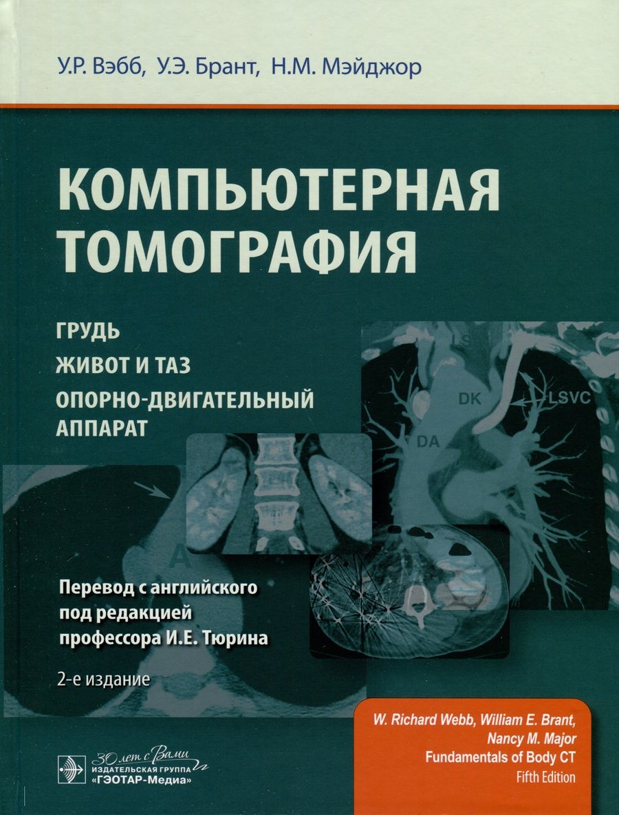 Обложка книги "Вэбб, Брант, Мэйджор: Компьютерная томография. Грудь, живот и таз, опорно-двигательный аппарат"