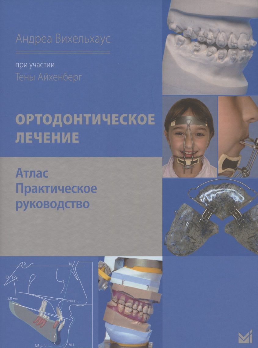 Обложка книги "Вихельхаус, Айхенберг: Ортодонтическое лечение. Атлас. Практическое руководство"
