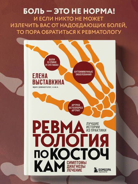 Фотография книги "Выставкина: Ревматология по косточкам. Симптомы, диагнозы, лечение"