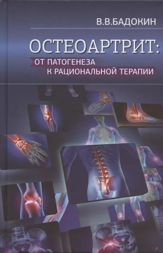 Обложка книги "Владимир Бадокин: Остеоартрит: от патогенеза к рациональной терапии"