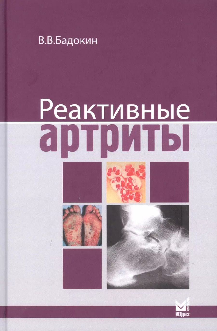 Обложка книги "Владимир Бадокин: Реактивные артриты"