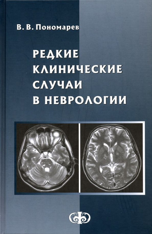Обложка книги "Владимир Пономарев: Редкие клинические случаи в неврологии (случаи из практики). Руководство для врачей"