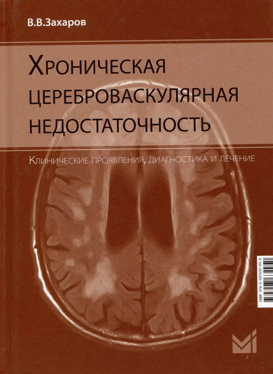 Обложка книги "Владимир Захаров: Хроническая цереброваскулярная недостаточность"