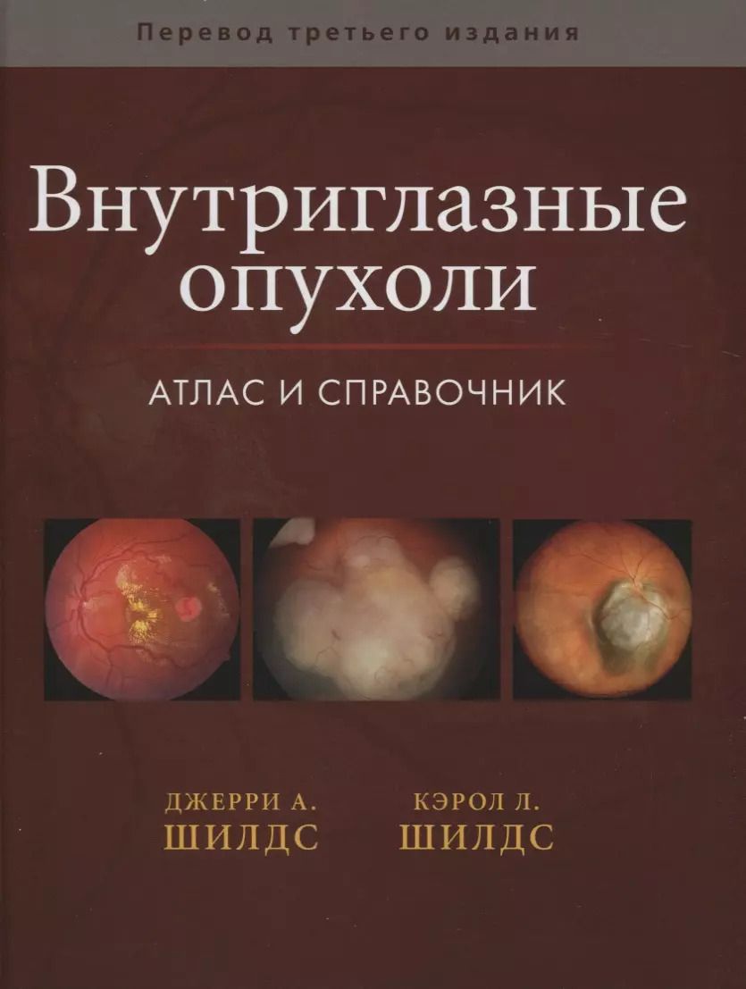 Обложка книги "Внутриглазные опухоли. Атлас и справочник"