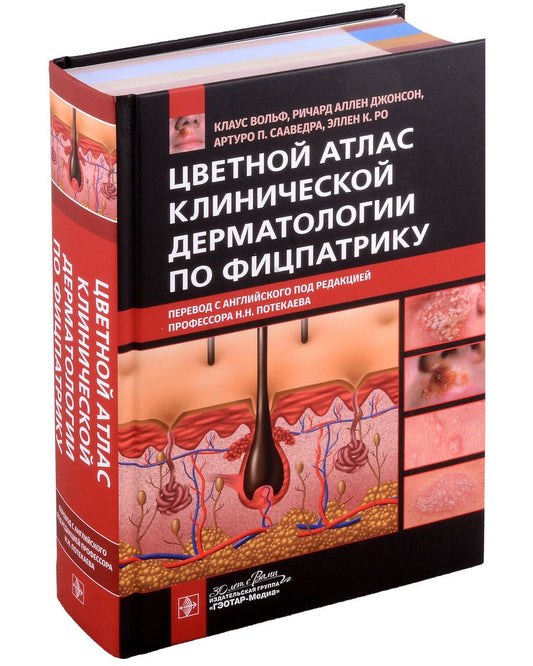 Обложка книги "Вольф, Джонсон, Сааведра: Цветной атлас клинической дерматологии по Фицпатрику"
