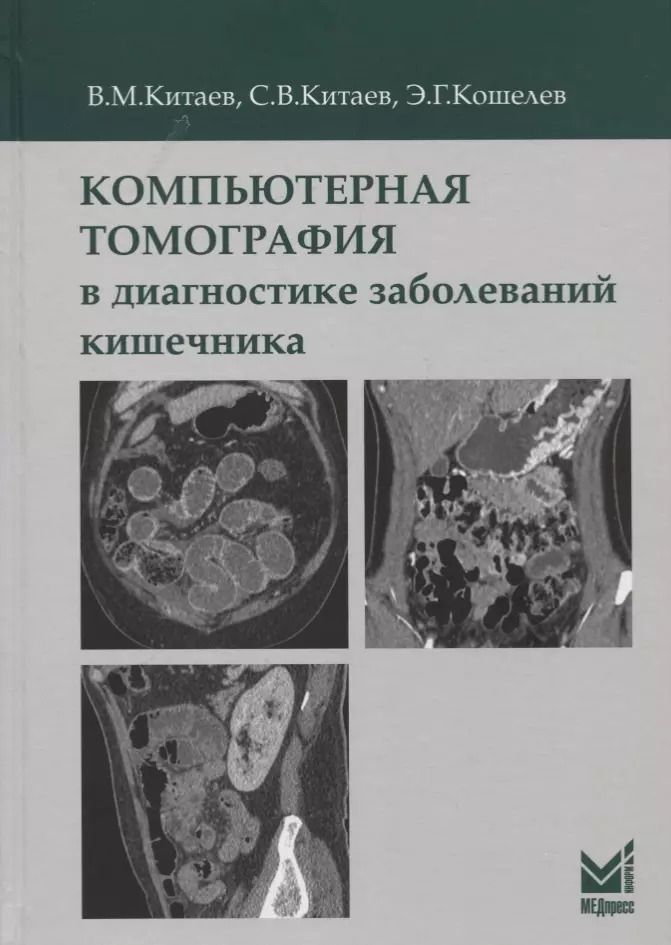 Обложка книги "Вячеслав Китаев: Компьютерная томография в диагностике заболеваний кишечника"