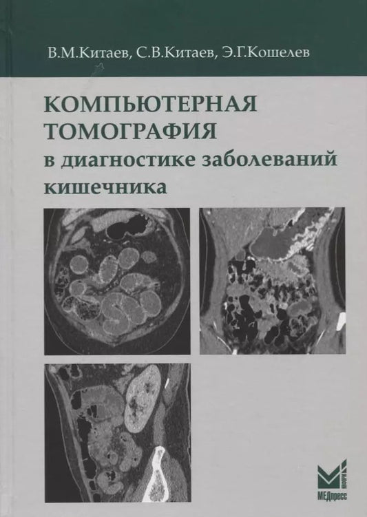 Обложка книги "Вячеслав Китаев: Компьютерная томография в диагностике заболеваний кишечника"