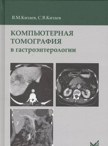 Обложка книги "Вячеслав Китаев: Компьютерная томография в гастроэнтерологии"