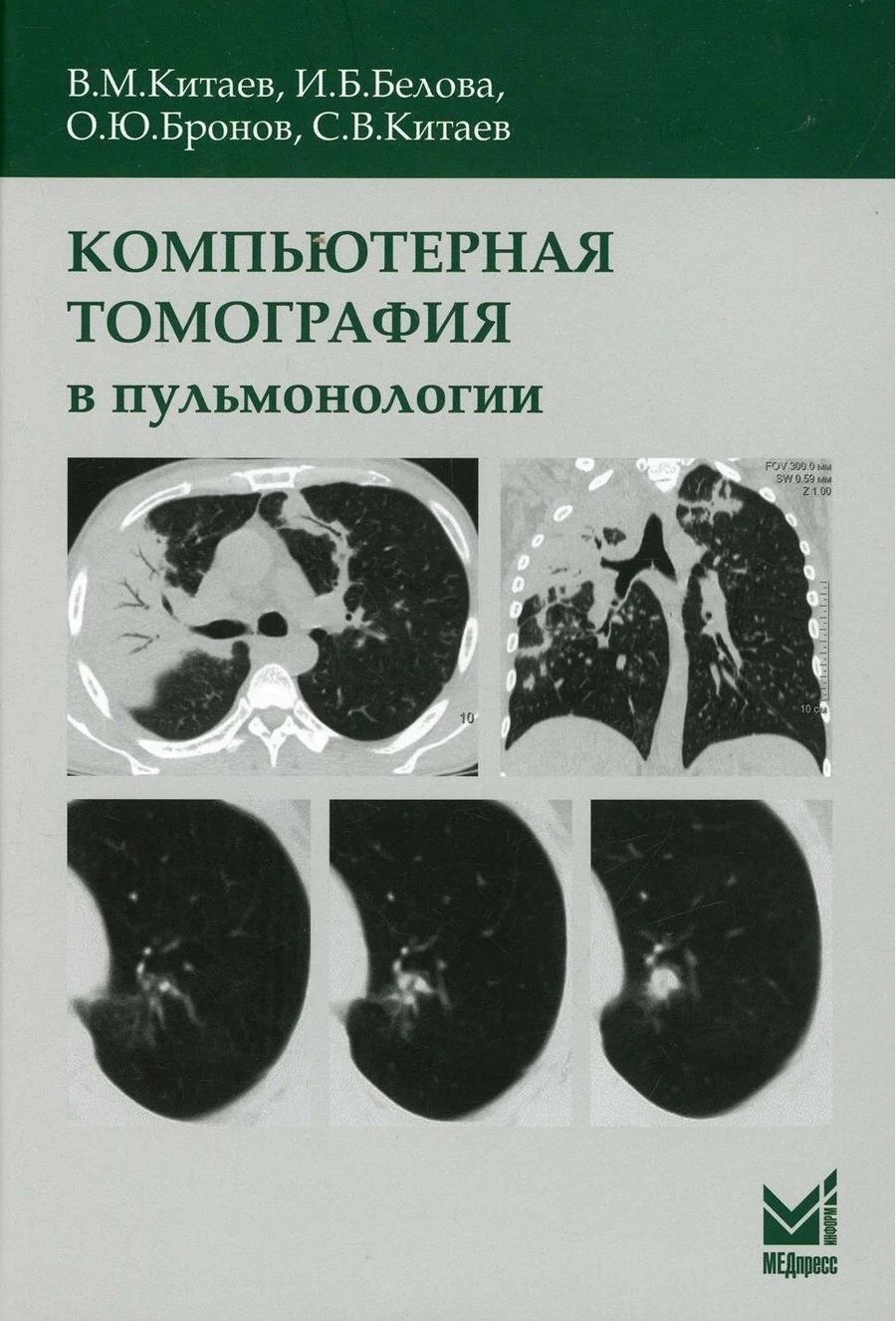 Обложка книги "Вячеслав Китаев: Компьютерная томография в пульмонологии"