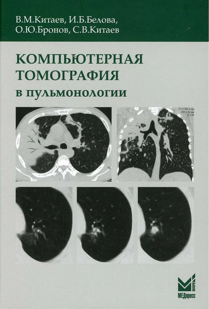 Обложка книги "Вячеслав Китаев: Компьютерная томография в пульмонологии"