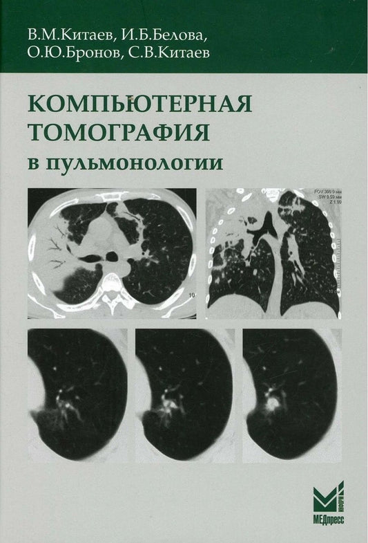 Обложка книги "Вячеслав Китаев: Компьютерная томография в пульмонологии"