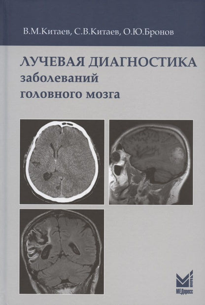 Обложка книги "Вячеслав Китаев: Лучевая диагностика заболеваний головного мозга. 3-е издание "