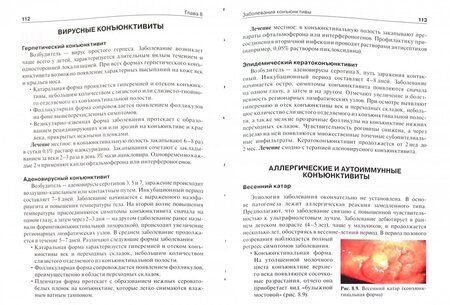 Фотография книги "Егоров, Алексеев, Астахов: Офтальмология. Учебник"