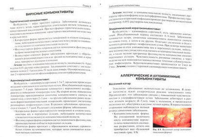 Фотография книги "Егоров, Алексеев, Астахов: Офтальмология. Учебник"