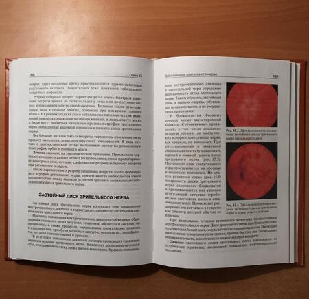 Фотография книги "Егоров, Алексеев, Астахов: Офтальмология. Учебник"