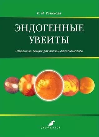 Обложка книги "Елена Устинова: Эндогенные уевиты. Избранные лекции для врачей-офтальмологов"