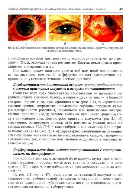 Фотография книги "Елена Устинова: Эндогенные уевиты. Избранные лекции для врачей-офтальмологов"