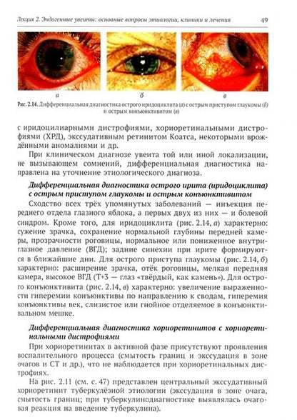 Фотография книги "Елена Устинова: Эндогенные уевиты. Избранные лекции для врачей-офтальмологов"