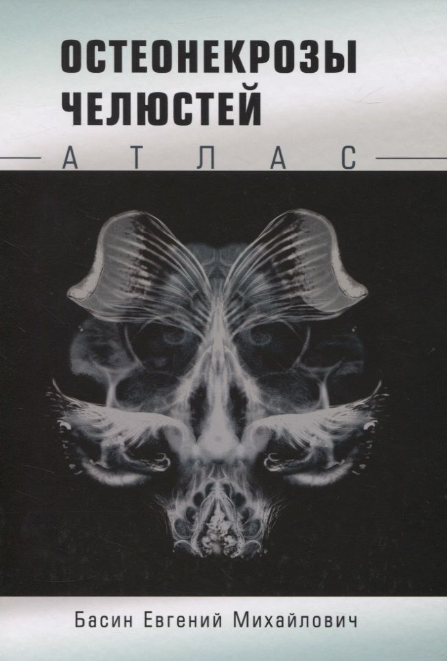 Обложка книги "Евгений Басин: Остеонекрозы челюстей. Атлас"