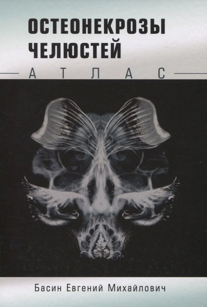 Обложка книги "Евгений Басин: Остеонекрозы челюстей. Атлас"