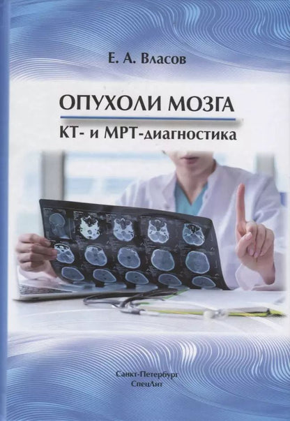 Обложка книги "Евгений Власов: Опухоли мозга КТ- и МРТ- диагностика"