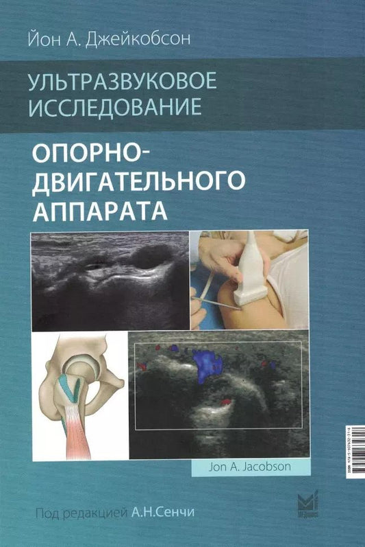 Обложка книги "Йон А.: Ультразвуковое исследование опорно-двигательного аппарата"