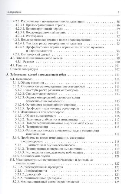 Фотография книги "Юань, Чэнь, Дои: Дентальная имплантация у пациентов с медицинскими факторами риска"