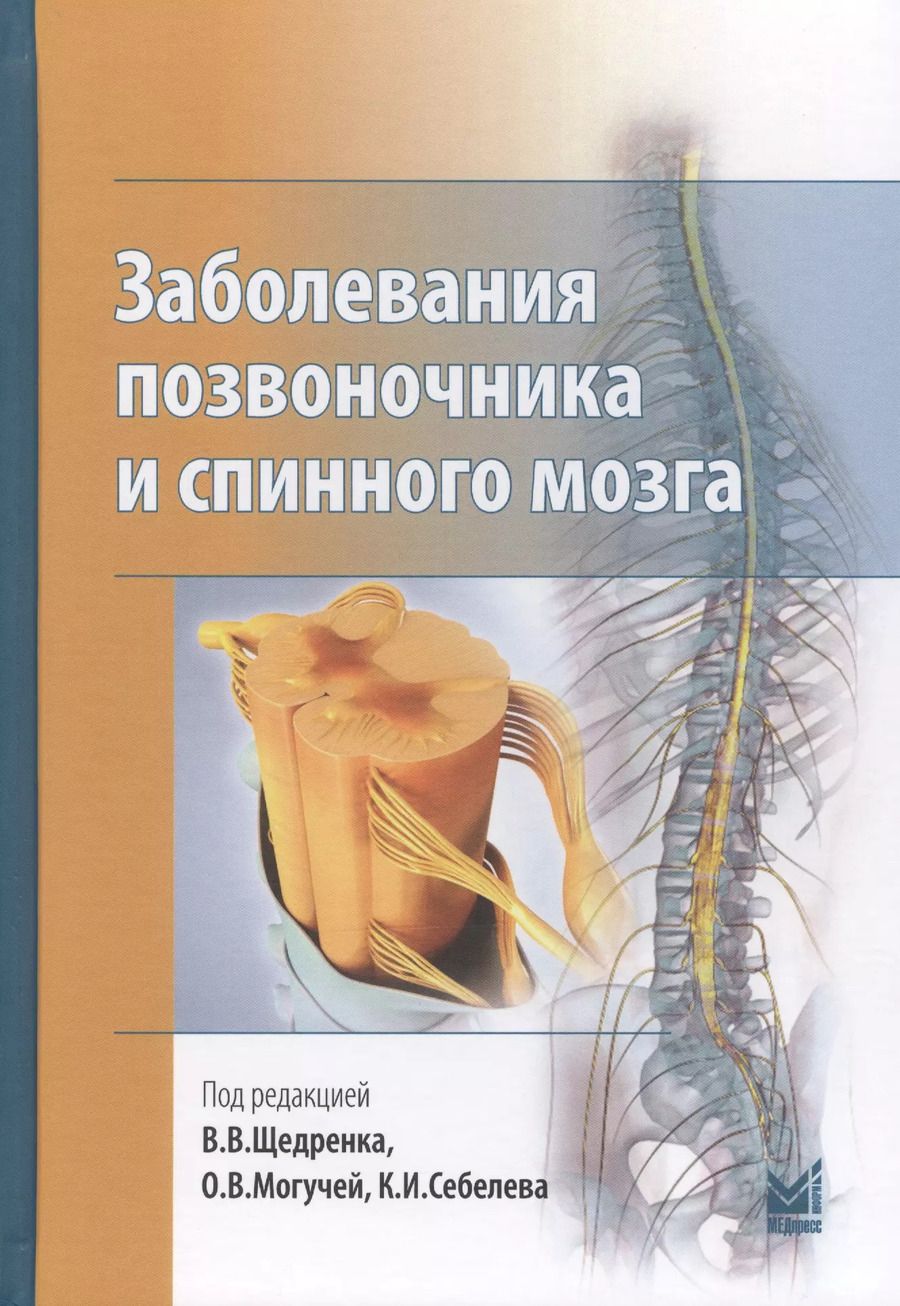 Обложка книги "Заболевания позвоночника и спинного мозга."