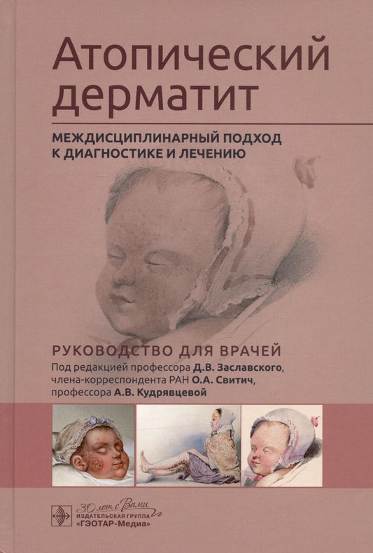Обложка книги "Заславский, Свитич, Кудрявцева: Атопический дерматит. Междисциплинарный подход к диагностике и лечению"