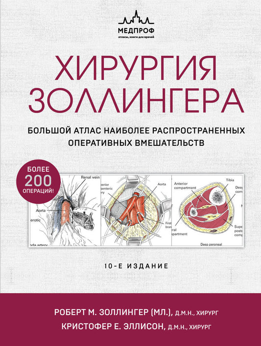 Обложка книги "Золлингер, Золлингер: Хирургия Золлингера. Большой атлас наиболее распространенных оперативных вмешательств"