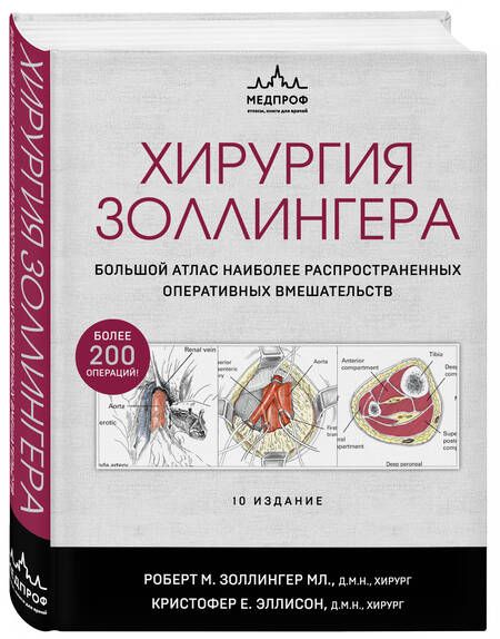 Фотография книги "Золлингер, Золлингер: Хирургия Золлингера. Большой атлас наиболее распространенных оперативных вмешательств"